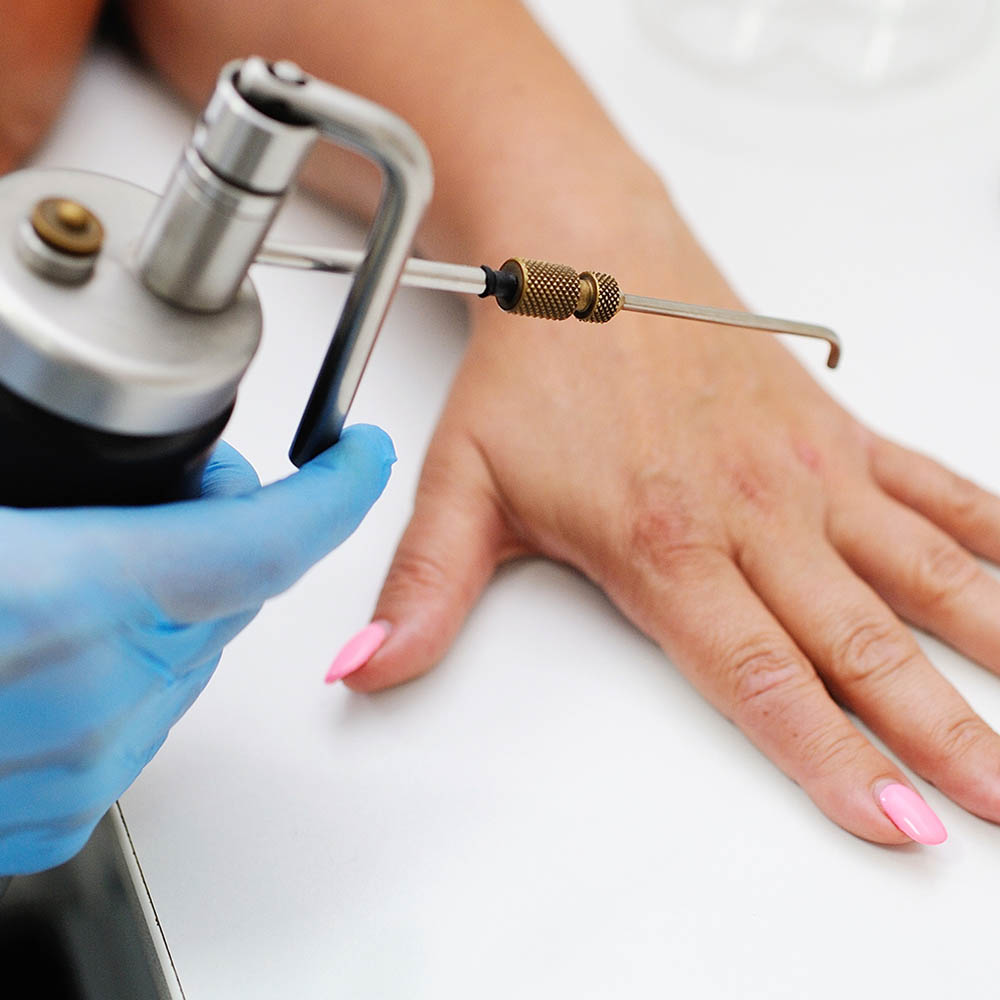 Cryotherapy for Pre-Cancerous Lesions