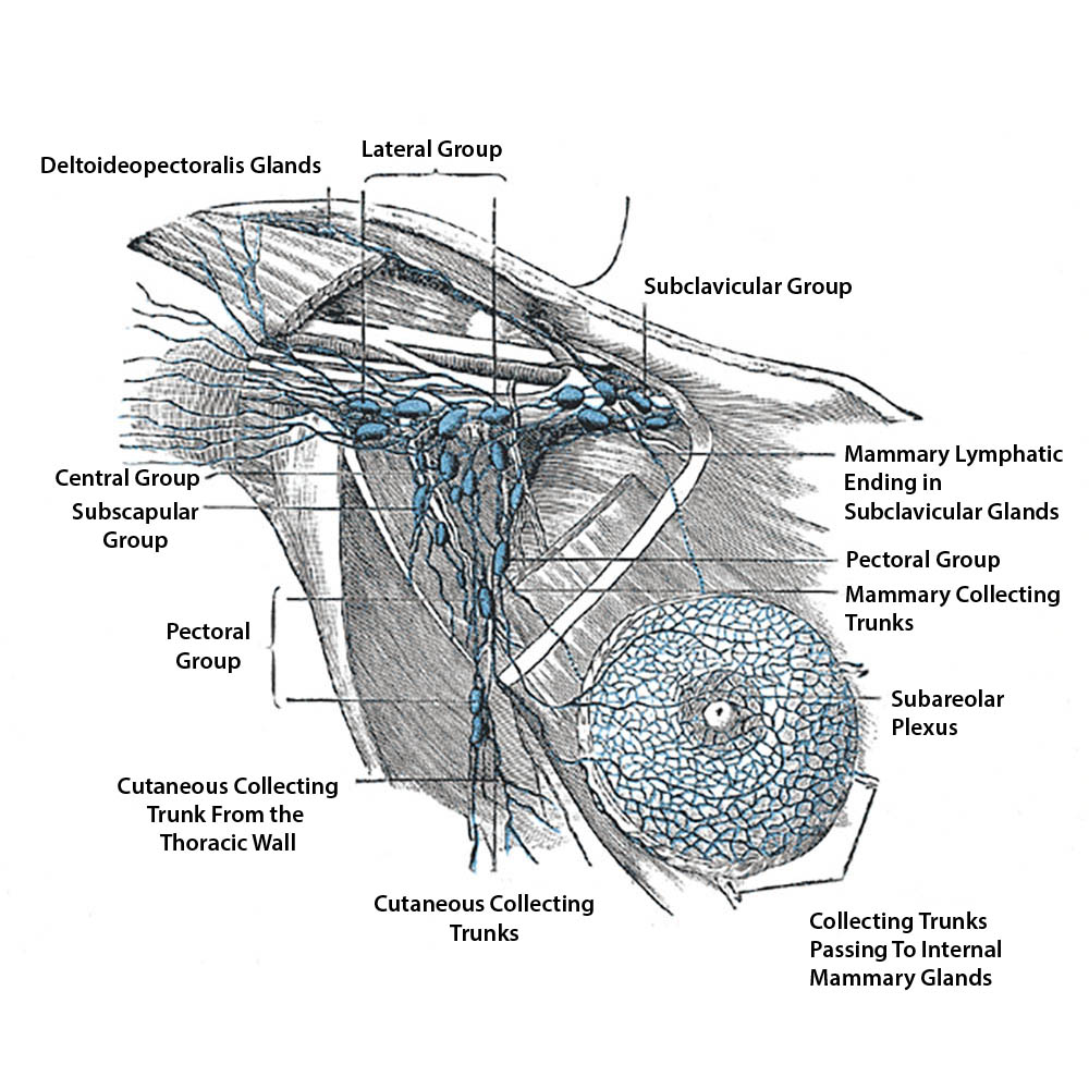 Sentinel Node Biopsy for Melanoma